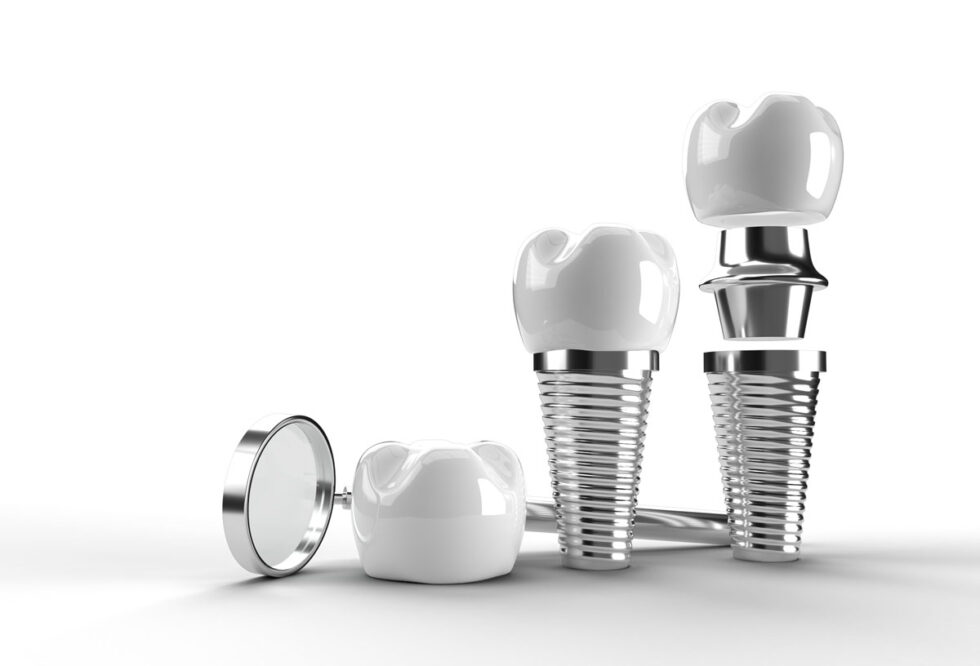 Types of Dental Implants Endosteal, Eposteal, Transosteal 1Dental Blog