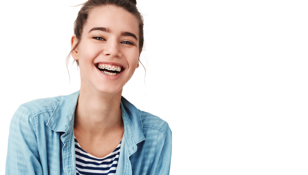 How Much Do Braces Cost Without Dental Insurance?